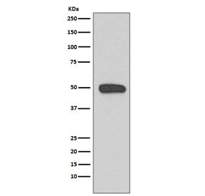 Western blot testing of human A431 cell lysate with KRT13 antibody. Predicted molecular weight ~50 k