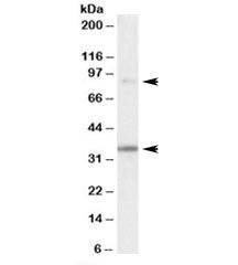 Western blot testing of human skeletal muscle lysate with LDB3 antibody at 0.1ug/ml. Predicted molec