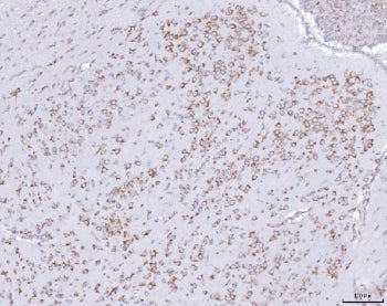 PRKRA Antibody / PACT