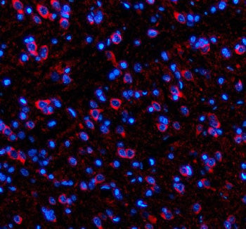 Immunofluorescent staining of SIK2 using anti-SIK2 antibody (red). SIK2 was detected in a paraffin-e