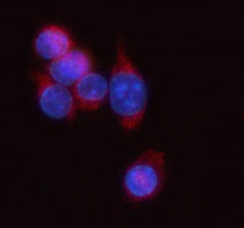Antigen peptide transporter 1 Antibody / Apt1 / Tap1