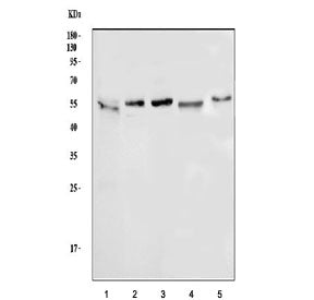 Western blot testing of 1) human PANC-1, 2) human HT1080, 3) human U-251, 4) rat C6 and 5) mouse tes