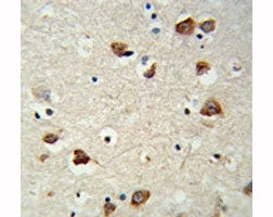 p70 S6 Kinase beta Antibody (RPS6KB2)