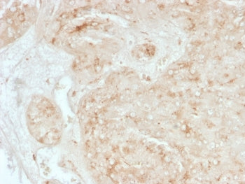 IHC staining of FFPE human adrenal gland tissue with StAR antibody (clone STAR/3976). HIER: boil tis