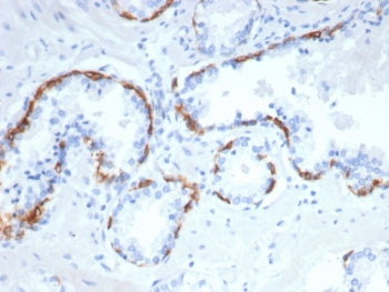 IHC staining of FFPE human prostate tissue with CK14 antibody (clone rKRT14/7290). HIER: boil tissue