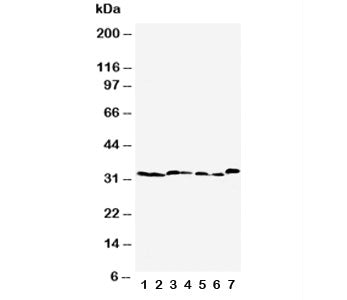 Western blot testing of Caspase-6 antibody and Lane 1: rat liver; 2: rat kidney; 3: rat testis; 4: N