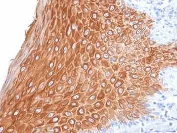 IHC testing of FFPE human skin with recombinant Keratin 16 antibody (clone KRT16/2043R). Required HI