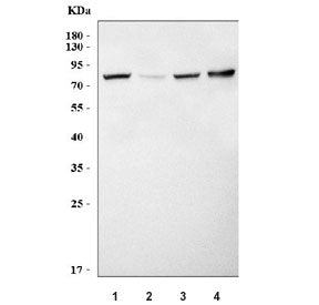 Smpd1 Antibody / Acid sphingomyelinase / aSMase