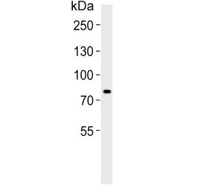 Western blot testing of human HT-1080 cell lysate with AGAP4 antibody. Predicted molecular weight ~7