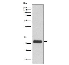Western blot testing of human 293T cell lysate with GPX1 antibody. Predicted molecular weight ~22 kD