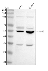 Western blot analysis of MMP20 using anti-MMP20 antibody. Lane 1: human Hela whole cell lysates, Lan