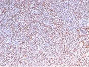 ALK Antibody / Anaplastic Lymphoma Kinase