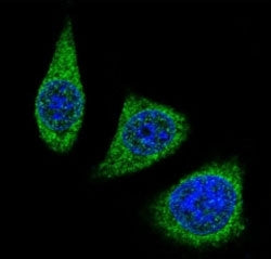 Confocal immunofluorescent analysis of MMP7 antibody with 293 cells followed by Alexa Fluor 488-conj