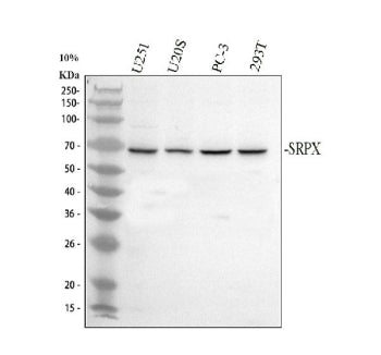 Western blot analysis of SRPX using anti-SRPX antibody. Electrophoresis was performed on a 10% SDS-P