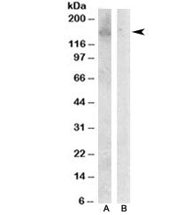 Western blot testing of Jurkat lysate with HER3 antibody at 0.1ug/ml with [B] and without [A] immuni