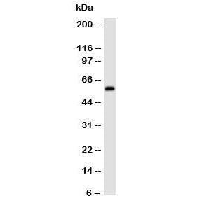 Western blot testing of Aromatase antibody and human placenta lysate. Predicted molecular weight ~58