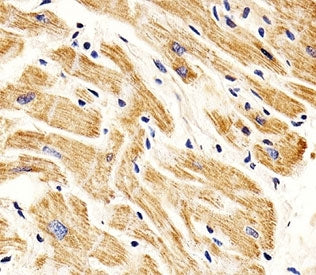 SMAD1 Antibody
