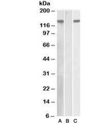 Western blot of HEK293 lysate overexpressing human NLRP2 with DYKDDDDK tag probed with NALP2 antibod