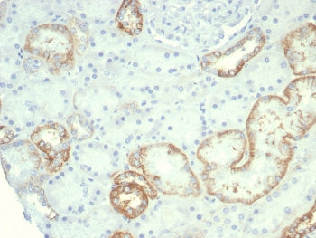 Cadherin 16 Antibody