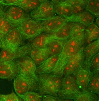 RRP1B Antibody / Ribosomal RNA processing protein 1 homolog B