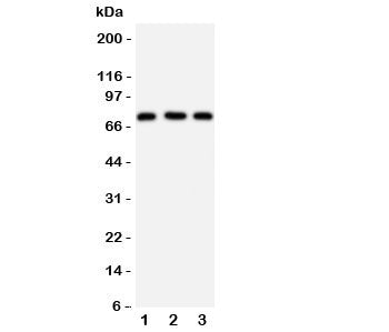 Western blot testing of VASA antibody and Lane 1: rat testis; 2: mouse testis; 3: HeLa cell lysate