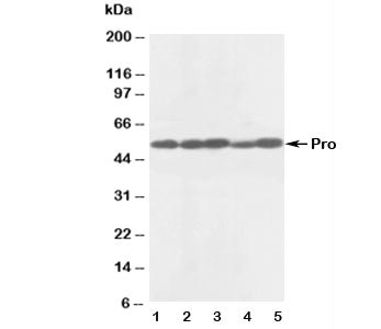 Western blot testing of anti-Caspase-8 antibody and Lane 1: rat thymus; 2: rat liver; 3: human MCF-7