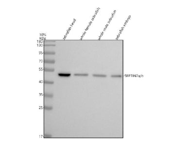 Western blot analysis of Septin7a/b protein using Zebrafish Septin7 antibody and 1) zebrafish head, 