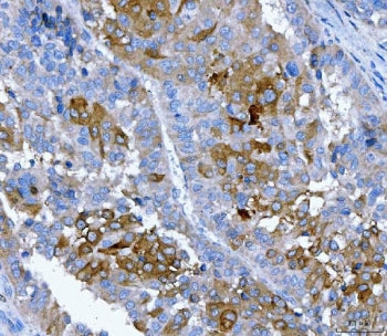 FGFR2 Antibody / Fibroblast growth factor receptor 2