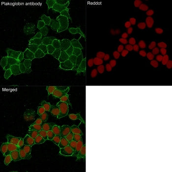 Immunofluorescent staining of human HeLa cells with Plakoglobin antibody (clone 15F11, green) and Re