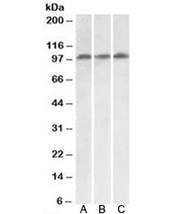 Western blot testing of HeLa [A], HepG2 [B] and Jurkat [C] lysates with VPS16 antibody at 0.1ug/ml. 