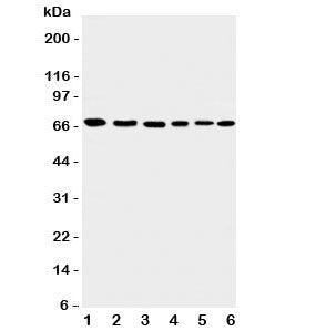 Western blot testing of Apoptosis-Inducing Factor antibody and Lane 1: rat heart; 2: (r) brain; 3: h