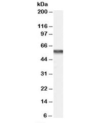 Western blot testing of human bone marrow lysate with CACNB4 antibody at 0.2ug/ml. Predicted molecul