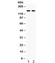 Calcium Sensing Receptor Antibody / CASR