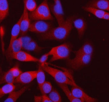 Immunofluorescent staining of FFPE human HeLa cells with PFKM antibody (red) and DAPI nuclear stain 