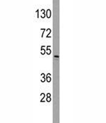 ILK Antibody