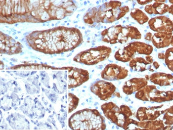 IHC staining of FFPE human brain tissue with GLUL antibody (clone GLUL/8256R). Inset: PBS used in pl