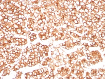 P Glycoprotein Antibody / MDR1 / ABCB1