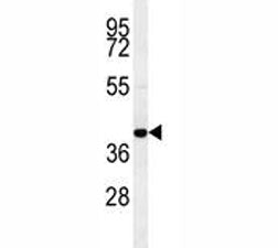 Western blot testing of human MDA-MB-435 cell lysate with CCR8 antibody. Predicted molecular weight 