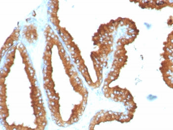 IHC staining of FFPE human prostate tissue with CD63 antibody (clone LAMP3/8248R). HIER: boil tissue