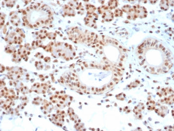 MGMT Antibody