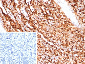 CD74 Antibody