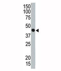 TSG101 Antibody