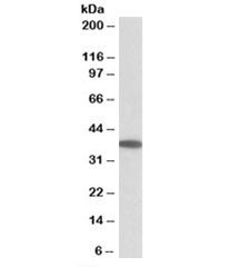 Western blot testing of human duodenum lysate with MOGAT2 antibody at 0.05ug/ml. Predicted/observed 