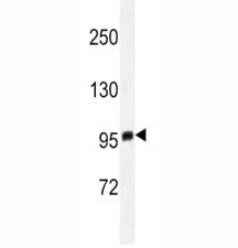 EZH2 Antibody, 0.08ml