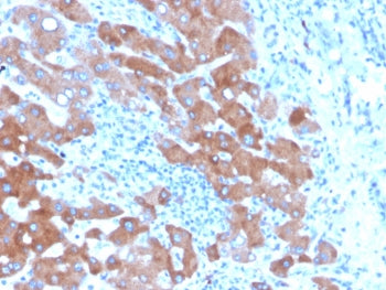 IHC staining of FFPE human liver tissue with Transferrin antibody (clone TF/4796). HIER: boil tissue