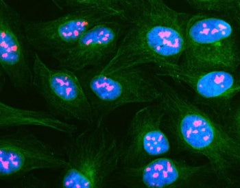 Immunofluorescent staining of FFPE human U-2 OS cells with Nucleolar protein 2 antibody (red), Beta 