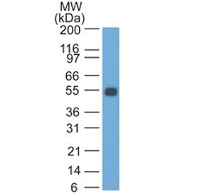 EpCAM Antibody
