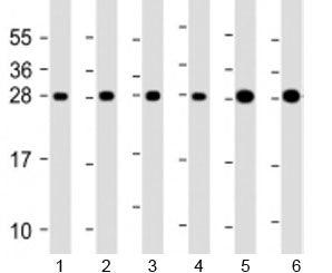 Western blot testing of human 1) HeLa, 2) Jurkat, 3) MCF-7, 4) 293T/17, 5) U-2OS and 6) A431 cell ly