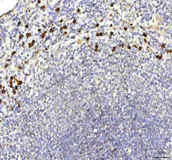 IHC staining of FFPE human spleen tissue with S100A12 antibody. HIER: boil tissue sections in pH8 ED