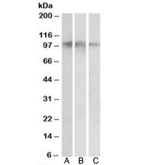 Western blot testing of human hippocampus [A], cerebral cortex [B] and cerebellum [C] lysates with N